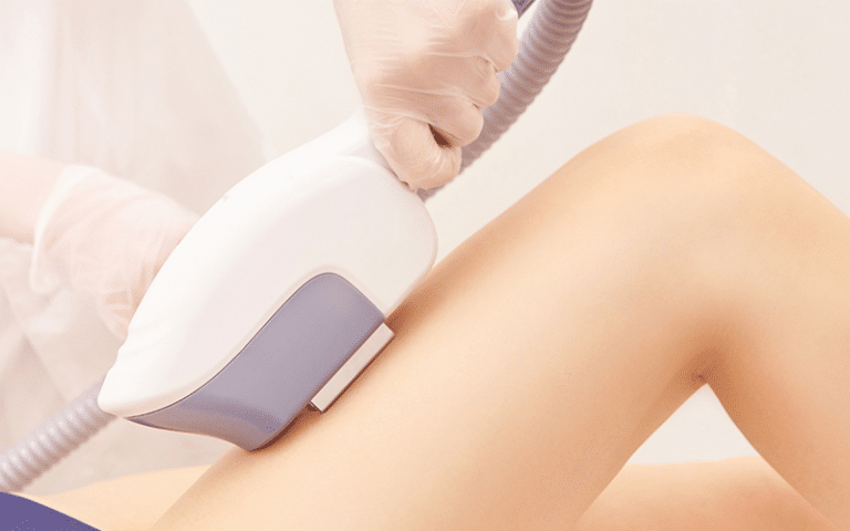 Get Silky Smooth Skin at Home with Our IPL Hair Removal Machine