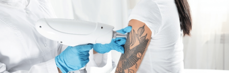 Can Laser Tattoo Removal Cause Scarring?