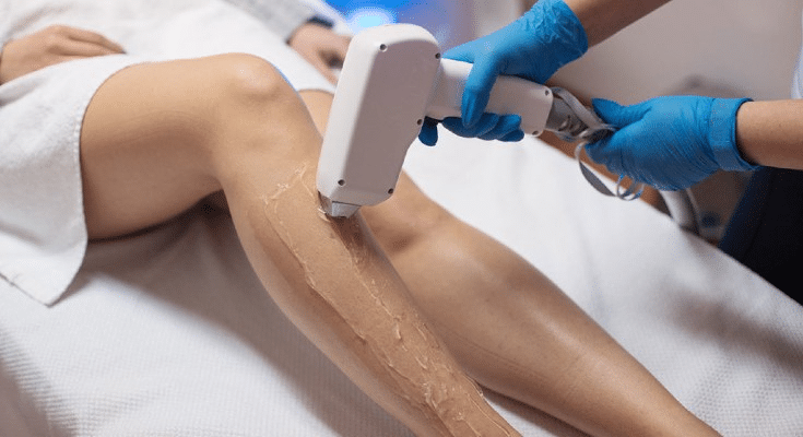 How Long Does Laser Hair Removal Take?