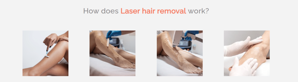 How to use a laser hair removal machine?